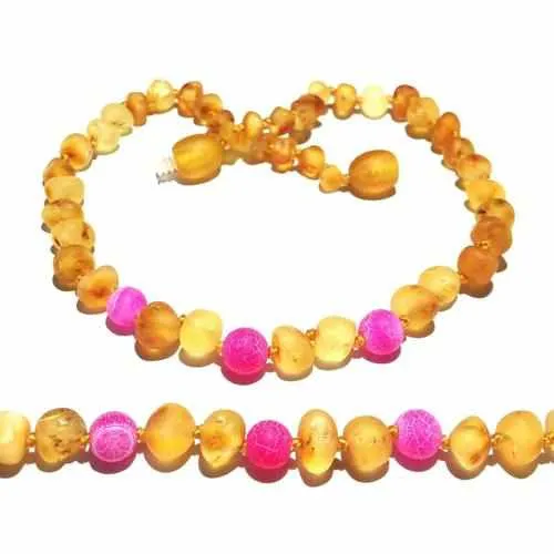 Adult Nurture Raw Honey Pink Agate Baltic Amber Bead Anklet